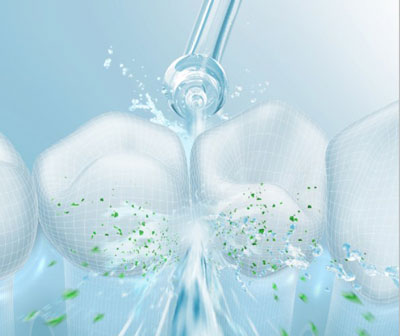 Mejor irrigador dental presión