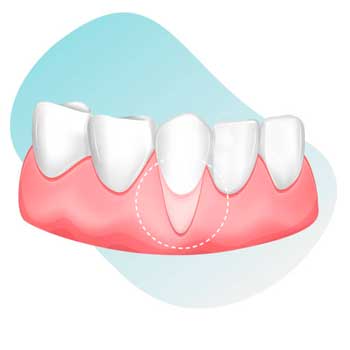 Mejores Cepillos Eléctricos